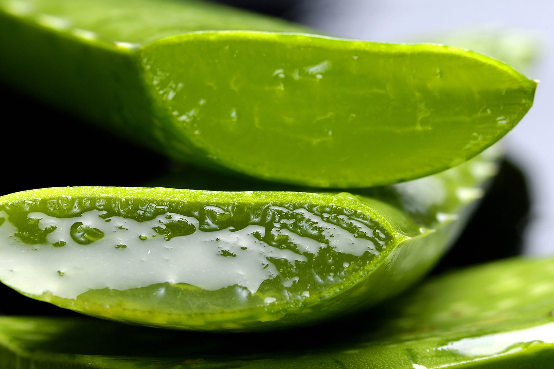 Dandruff Causes And Natural Remedies