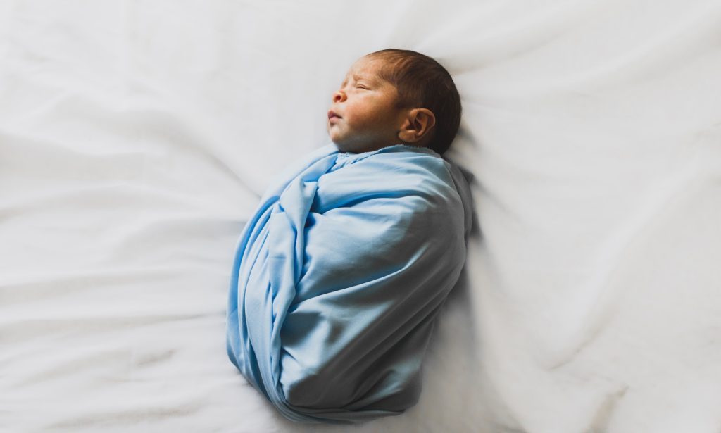 Newborn Belly Button Bleeding: When To Seek Medical Support